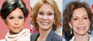 mary tyler moore plastic surgery before and after