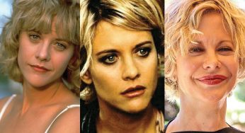 Meg Ryan Plastic Surgery
