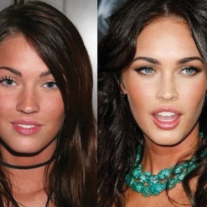 Megan Fox Plastic Surgery