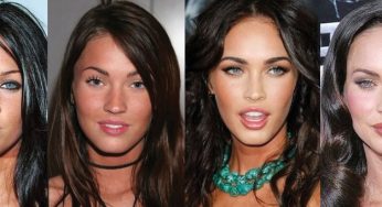 Megan Fox Plastic Surgery