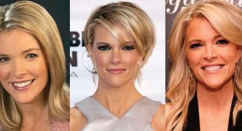 Megyn Kelly Plastic Surgery