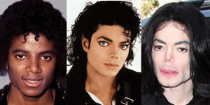 michael jackson plastic surgery before and after