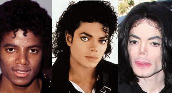 Michael Jackson Plastic Surgery