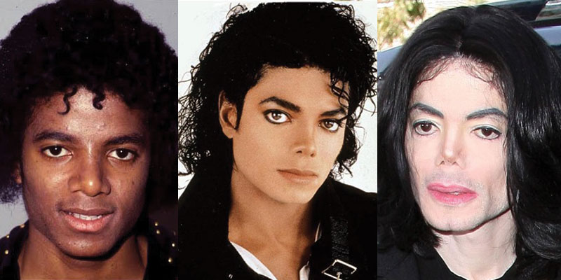 Michael Jackson Plastic Surgery Before And After Pictures 2025