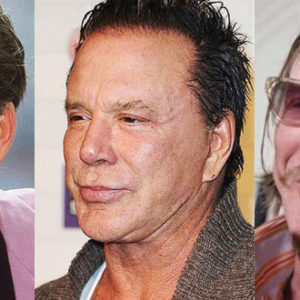 Mickey Rourke Plastic Surgery