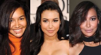 Naya Rivera Plastic Surgery