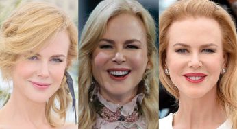 Nicole Kidman Plastic Surgery
