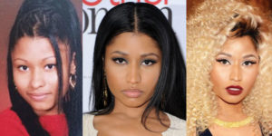 nicki minaj plastic surgery before and after