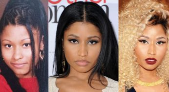 Nicki Minaj Plastic Surgery