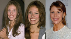 nikki cox plastic surgery before and after