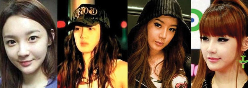 park bom before and after plastic surgery 2022