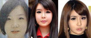 Park Bom Plastic Surgery Before and After Pictures 2025