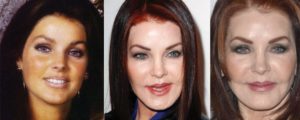 priscilla presley plastic surgery before and after