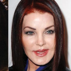 Priscilla Presley Plastic Surgery