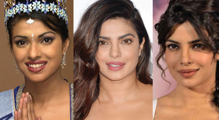 priyanka chopra plastic surgery before and after