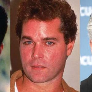 Ray Liotta Plastic Surgery