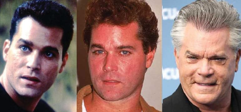 ray liotta plastic surgery before and after 2022