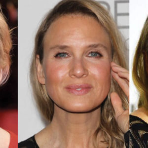 Renee Zellweger Plastic Surgery