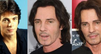 Rick Springfield Plastic Surgery
