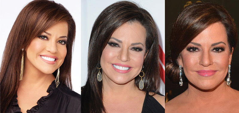 robin meade plastic surgery before and after