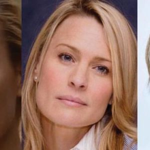 Robin Wright Penn Plastic Surgery