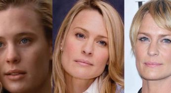 Robin Wright Penn Plastic Surgery