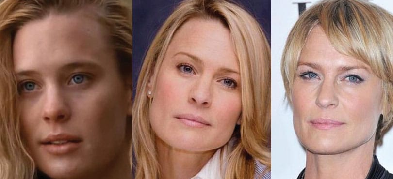 robin wright penn plastic surgery before and after