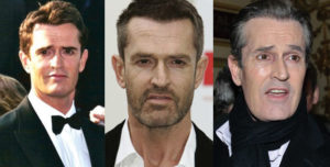 rupert everett plastic surgery before and after