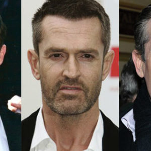 Rupert Everett Plastic Surgery