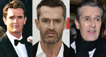 Rupert Everett Plastic Surgery
