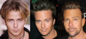 sean patrick flanery plastic surgery before and after