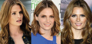 stana katic plastic surgery before and after