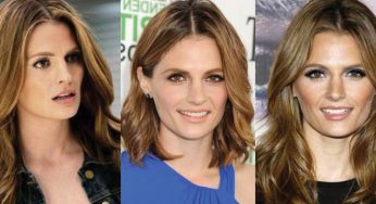 Stana Katic Plastic Surgery