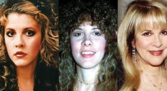 Stevie Nicks Plastic Surgery