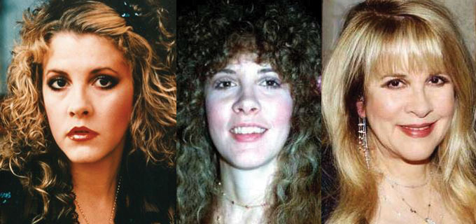 stevie nicks plastic surgery before and after