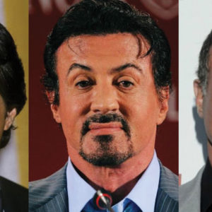 Sylvester Stallone Plastic Surgery