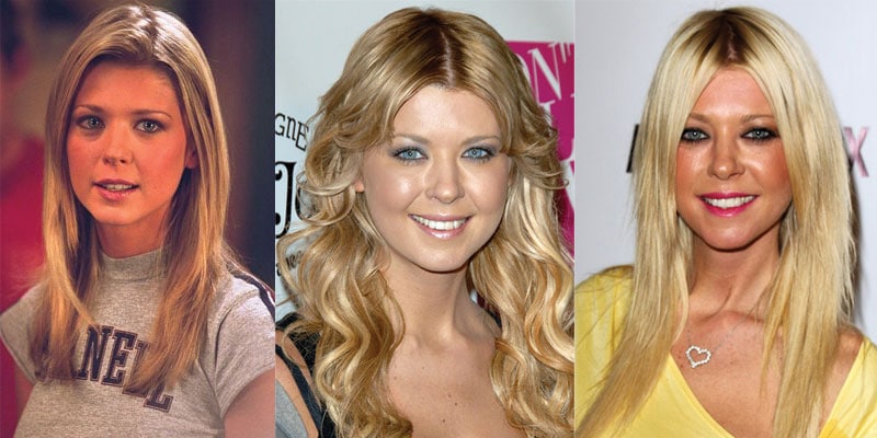 tara reid plastic surgery before and after