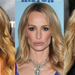 Taylor Armstrong Plastic Surgery