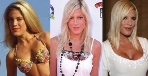 tori spelling before and after plastic surgery
