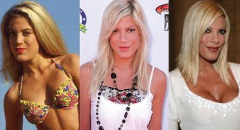 Tori Spelling Plastic Surgery