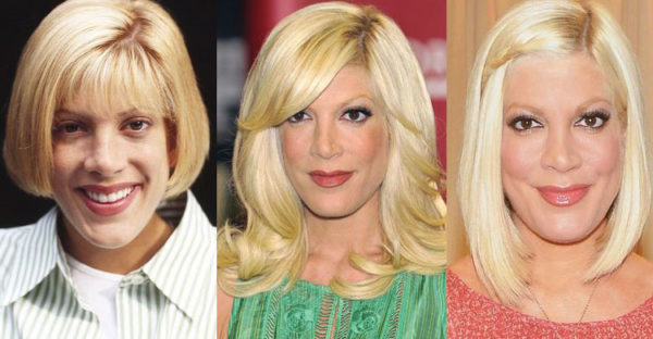 Tori Spelling Plastic Surgery Before and After Pictures 2021