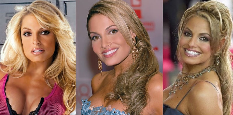 trish stratus plastic surgery before and after